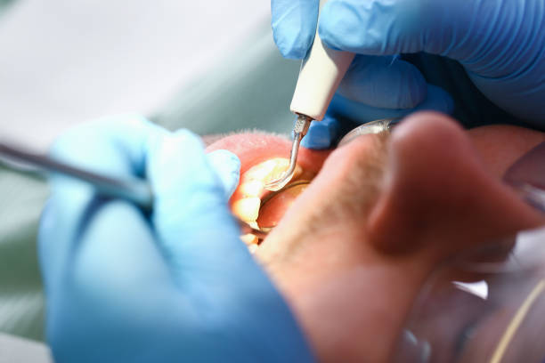 Best Dentist for Severe Toothache  in Ferry Pass, FL